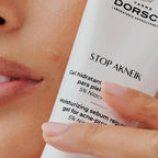 Farma Dorsch Stop Akneik, ayuda a regular el sebo