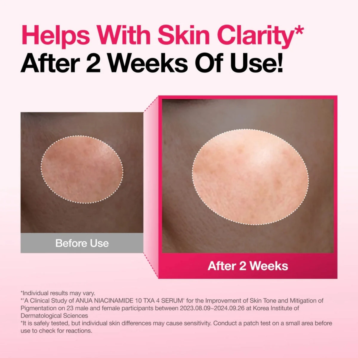 Anua Niacinamide 10% + TXA 4% Serum con ácido tranexámico al 4%