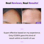 COSRX AHA/BHA Clarifying Treatment Toner con aguas botánicas de sauce y manzana