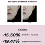 COSRX The Niacinamide 15 Serum, ayuda a controlar el exceso de sebo