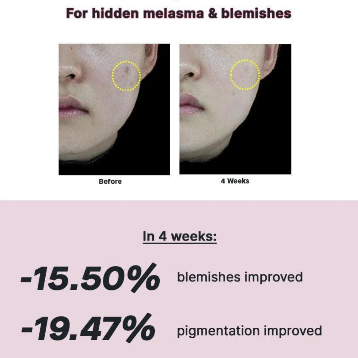 COSRX The Niacinamide 15 Serum, ayuda a controlar el exceso de sebo