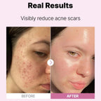 COSRX The Niacinamide 15 Serum, afina la apariencia del poro