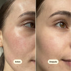 Freshly Cosmetics Cica Calm Moisturising Cream, calma la irritación y el picor