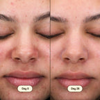 Freshly Cosmetics Salicylic Facial Cleanser, combate el acné respetando la microbiota
