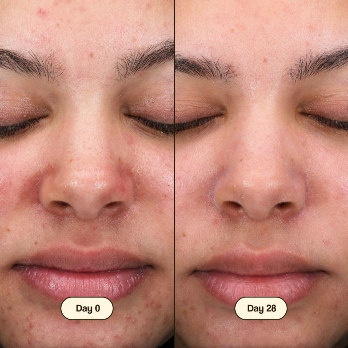 Freshly Cosmetics Salicylic Facial Cleanser, combate el acné respetando la microbiota