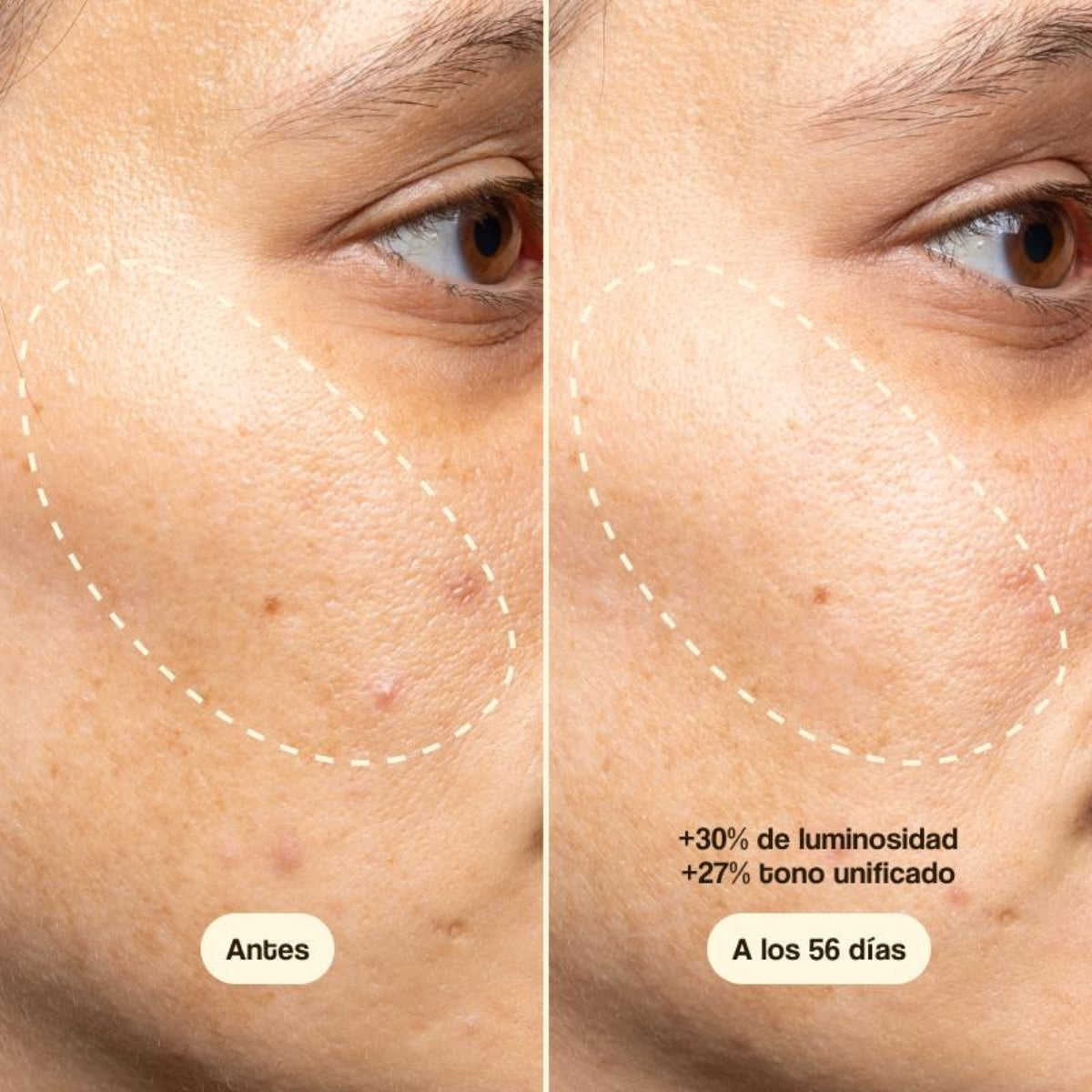 Freshly Cosmetics Vitamin C Advanced Treatment, unifica el tono de la piel