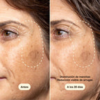 Freshly Cosmetics Vitamin C Advanced Treatment, apto para pieles sensibles