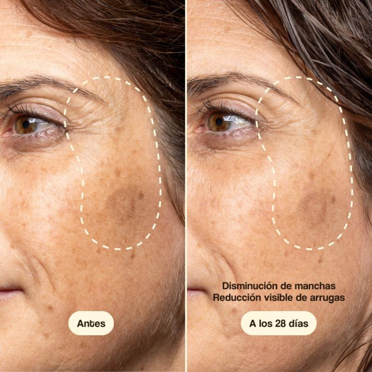 Freshly Cosmetics Vitamin C Advanced Treatment, apto para pieles sensibles