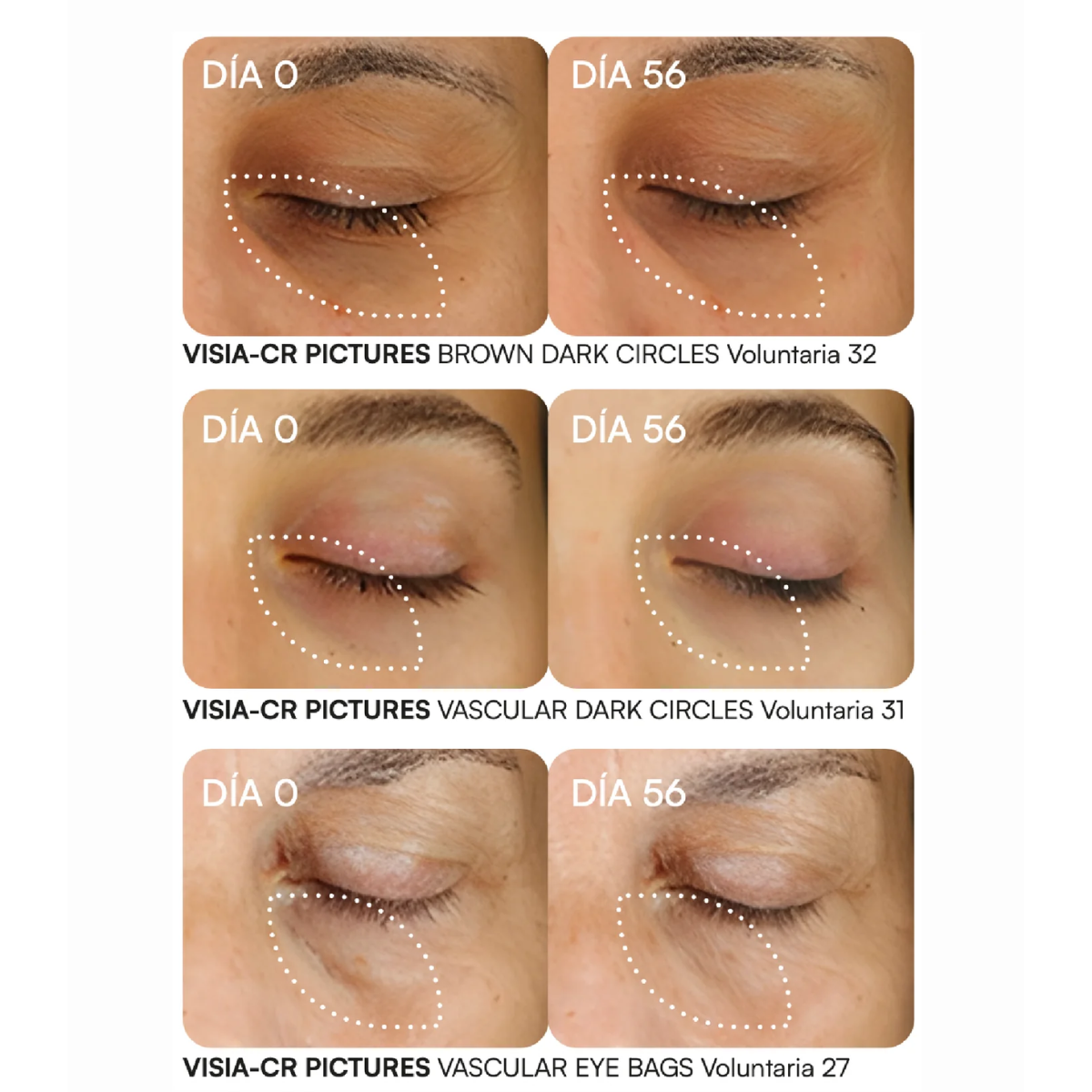 GH K-AT Serum Ojeras y Bolsas 15 ml