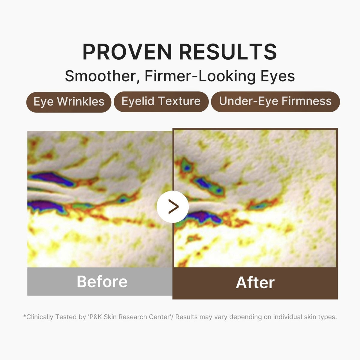 Medicube Deep Lifting Peptide Eye Cream For Face, se puede aplicar también en todo el rostro
