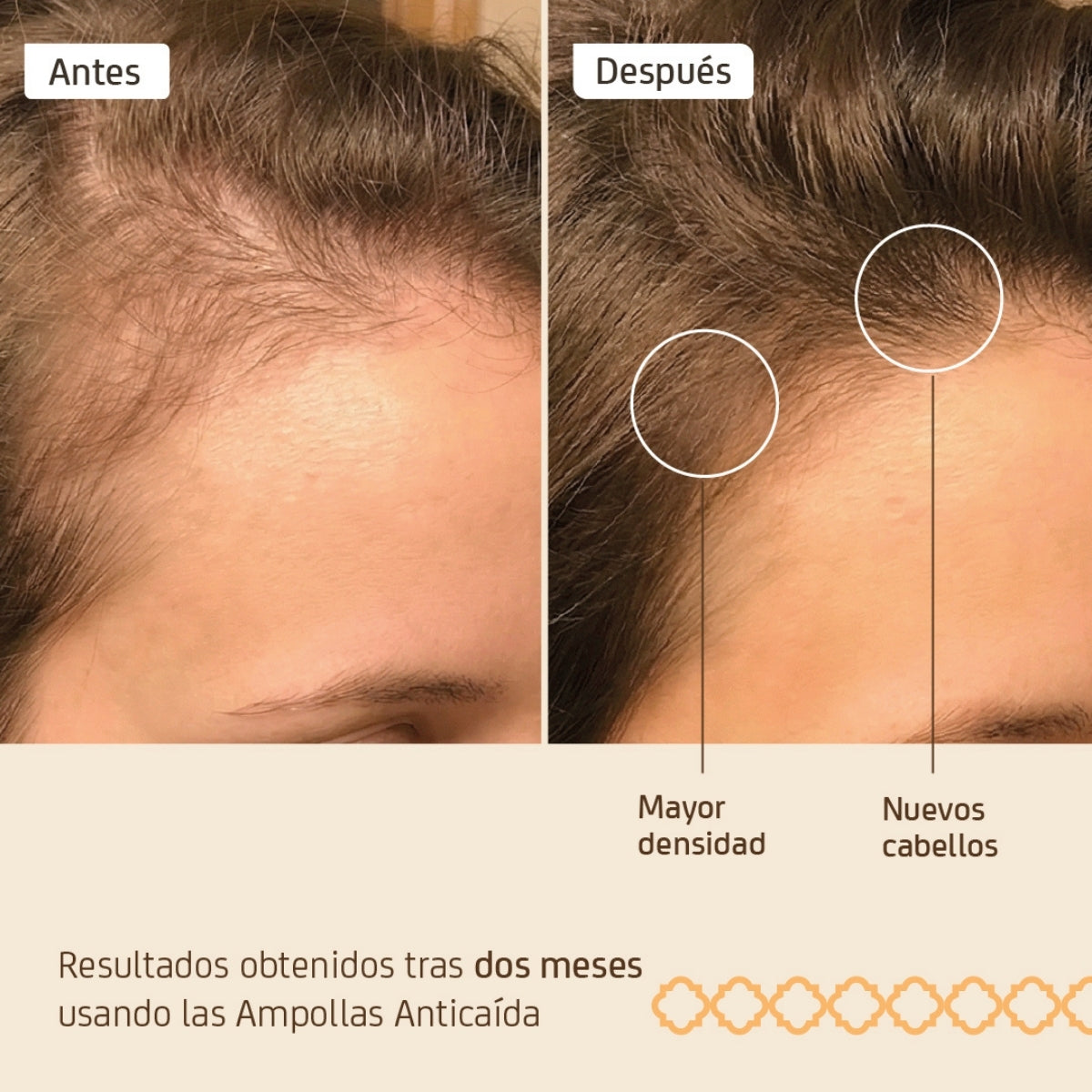 Ampollas anticaída pack 4 uds 10 ml