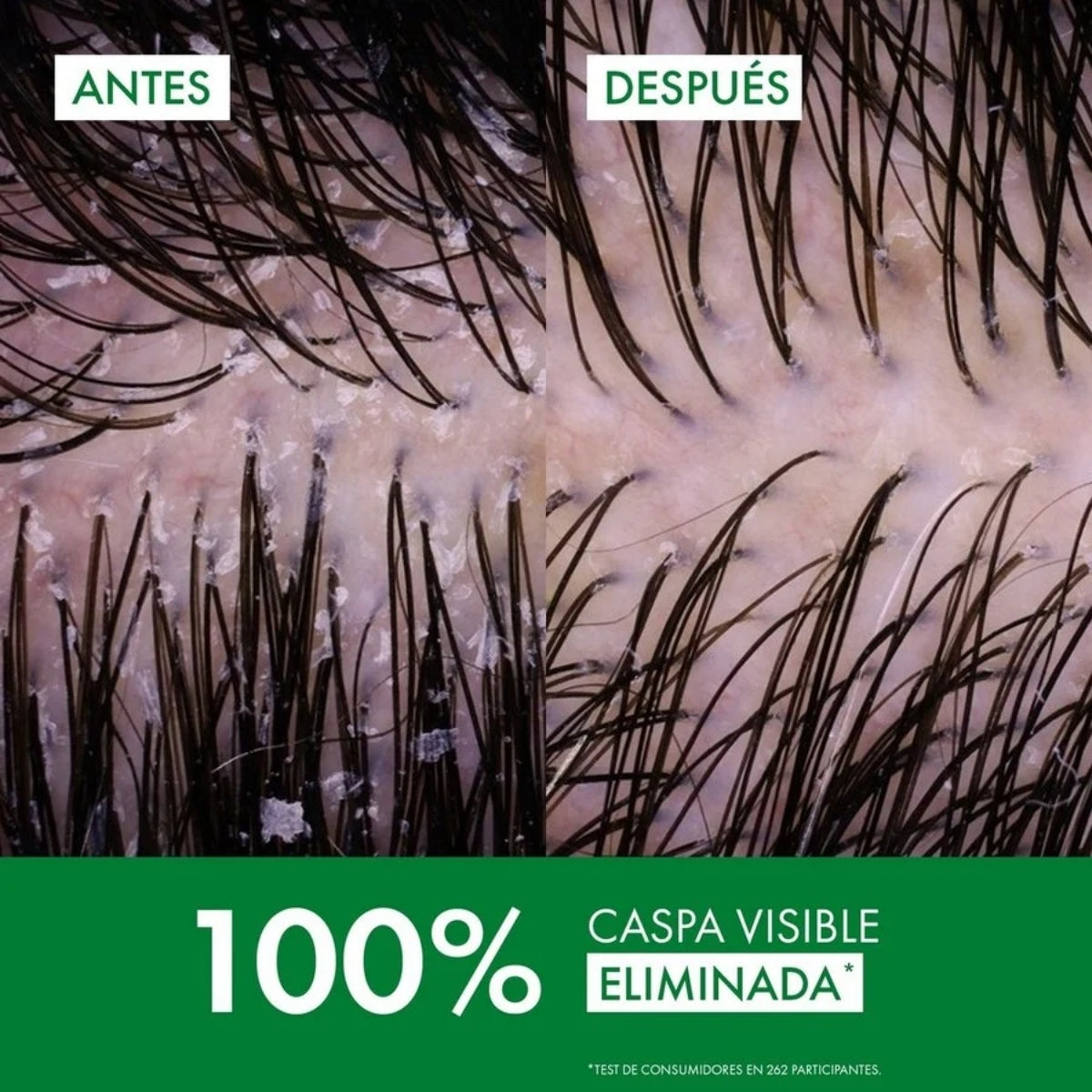 Vichy Dercos Champú Anticaspa Cabello Seco, acción antirrecaída probada durante 6 semanas